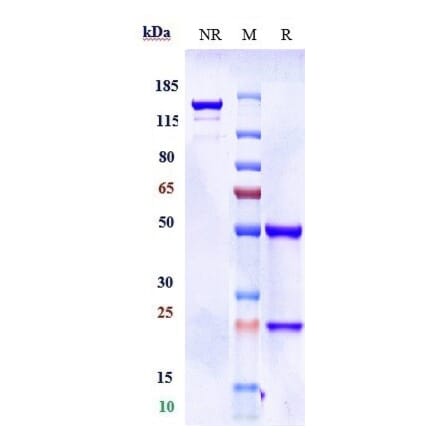 SDS-PAGE - Donanemab Biosimilar - Anti-beta Amyloid Antibody - Low endotoxin, Azide free (A323400) - Antibodies.com