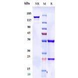 SDS-PAGE - Donanemab Biosimilar - Anti-beta Amyloid Antibody - Low endotoxin, Azide free (A323400) - Antibodies.com