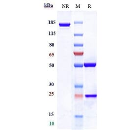 SDS-PAGE - Dostarlimab Biosimilar - Anti-PD1 Antibody - Low endotoxin, Azide free (A323401) - Antibodies.com