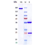 SDS-PAGE - Dostarlimab Biosimilar - Anti-PD1 Antibody - Low endotoxin, Azide free (A323401) - Antibodies.com