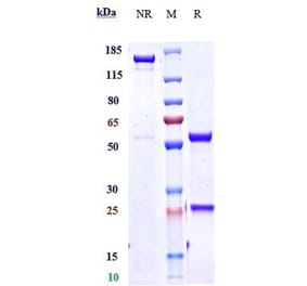 SDS-PAGE - Dupilumab Biosimilar - Anti-IL-4R Antibody - Low endotoxin, Azide free (A323403) - Antibodies.com