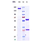 SDS-PAGE - Dupilumab Biosimilar - Anti-IL-4R Antibody - Low endotoxin, Azide free (A323403) - Antibodies.com