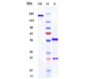 SDS-PAGE - Durvalumab Biosimilar - Anti-PD-L1 Antibody - Low endotoxin, Azide free (A323404) - Antibodies.com