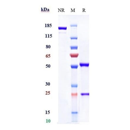 SDS-PAGE - Durvalumab Biosimilar - Anti-PD-L1 Antibody - Low endotoxin, Azide free (A323404) - Antibodies.com