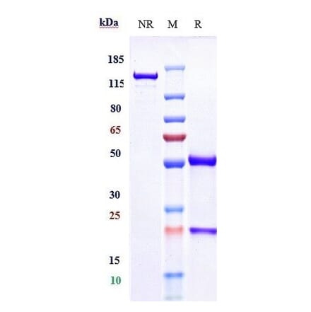 SDS-PAGE - Ebdarokimab Biosimilar - Anti-IL-12B Antibody - Low endotoxin, Azide free (A323405) - Antibodies.com