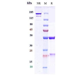 SDS-PAGE - Ebronucimab Biosimilar - Anti-PCSK9 Antibody - Low endotoxin, Azide free (A323406) - Antibodies.com