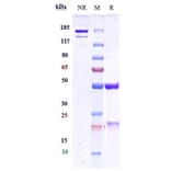 SDS-PAGE - Ebronucimab Biosimilar - Anti-PCSK9 Antibody - Low endotoxin, Azide free (A323406) - Antibodies.com