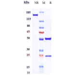 SDS-PAGE - Eldelumab Biosimilar - Anti-IP10 Antibody - Low endotoxin, Azide free (A323411) - Antibodies.com