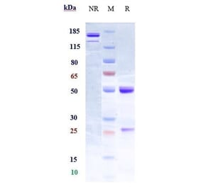 SDS-PAGE - Elezanumab Biosimilar - Anti-Repulsive Guidance Molecule A Antibody - Low endotoxin, Azide free (A323412) - Antibodies.com