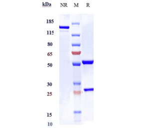 SDS-PAGE - Elsilimomab Biosimilar - Anti-IL-6 Antibody - Low endotoxin, Azide free (A323414) - Antibodies.com