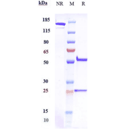 SDS-PAGE - Emactuzumab Biosimilar - Anti-CSF-1-R Antibody - Low endotoxin, Azide free (A323415) - Antibodies.com