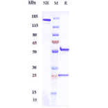 SDS-PAGE - Emactuzumab Biosimilar - Anti-CSF-1-R Antibody - Low endotoxin, Azide free (A323415) - Antibodies.com