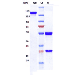 SDS-PAGE - Emapalumab Biosimilar - Anti-Interferon gamma Antibody - Low endotoxin, Azide free (A323416) - Antibodies.com