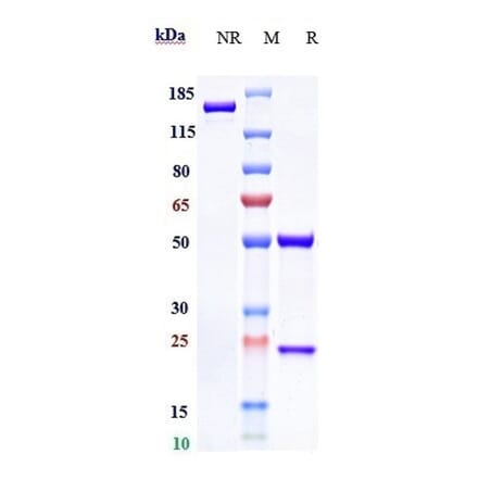 SDS-PAGE - Emibetuzumab Biosimilar - Anti-Met (c-Met) Antibody - Low endotoxin, Azide free (A323417) - Antibodies.com