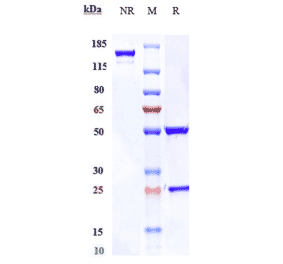SDS-PAGE - Enapotamab Biosimilar - Anti-Axl Antibody - Low endotoxin, Azide free (A323420) - Antibodies.com