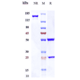 SDS-PAGE - Enapotamab Biosimilar - Anti-Axl Antibody - Low endotoxin, Azide free (A323420) - Antibodies.com