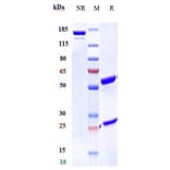 SDS-PAGE - Enavatuzumab Biosimilar - Anti-TWEAKR/FN14 Antibody - Low endotoxin, Azide free (A323421) - Antibodies.com