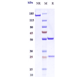 SDS-PAGE - Encelimab Biosimilar - Anti-LAG-3 Antibody - Low endotoxin, Azide free (A323422) - Antibodies.com