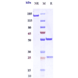 SDS-PAGE - Encelimab Biosimilar - Anti-LAG-3 Antibody - Low endotoxin, Azide free (A323422) - Antibodies.com