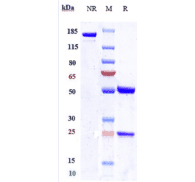 SDS-PAGE - Enfortumab Biosimilar - Anti-Nectin-4 Antibody - Low endotoxin, Azide free (A323423) - Antibodies.com
