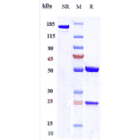 SDS-PAGE - Enfortumab Biosimilar - Anti-Nectin-4 Antibody - Low endotoxin, Azide free (A323423) - Antibodies.com