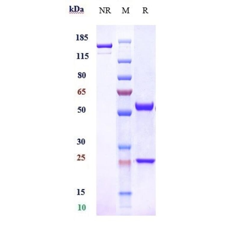 SDS-PAGE - Enibarcimab Biosimilar - Anti-Adrenomedullin/ADM Antibody - Low endotoxin, Azide free (A323425) - Antibodies.com