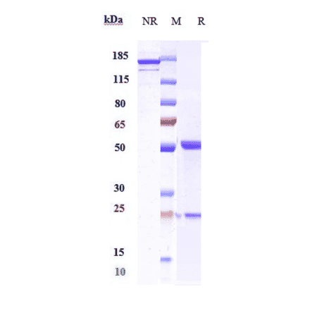 SDS-PAGE - Enoticumab Biosimilar - Anti-DLL4 Antibody - Low endotoxin, Azide free (A323428) - Antibodies.com