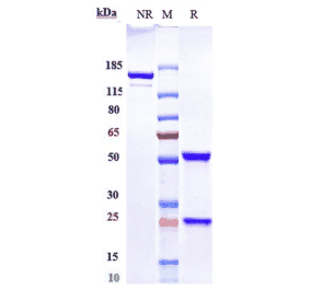 SDS-PAGE - Epratuzumab Biosimilar - Anti-CD22 Antibody - Low endotoxin, Azide free (A323432) - Antibodies.com