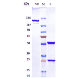 SDS-PAGE - Epratuzumab Biosimilar - Anti-CD22 Antibody - Low endotoxin, Azide free (A323432) - Antibodies.com
