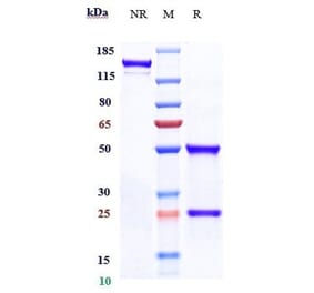 SDS-PAGE - Eptinezumab Biosimilar - Anti-CGRP-I Antibody - Low endotoxin, Azide free (A323433) - Antibodies.com