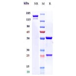 SDS-PAGE - Erenumab Biosimilar - Anti-CRLR Antibody - Low endotoxin, Azide free (A323434) - Antibodies.com