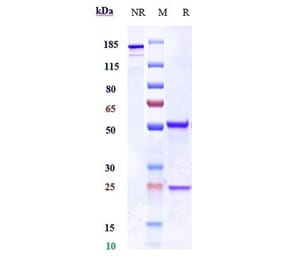 SDS-PAGE - Erlizumab Biosimilar - Anti-CD18 Antibody - Low endotoxin, Azide free (A323435) - Antibodies.com