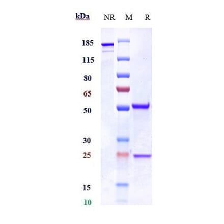 SDS-PAGE - Erlizumab Biosimilar - Anti-CD18 Antibody - Low endotoxin, Azide free (A323435) - Antibodies.com