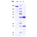 SDS-PAGE - Etaracizumab Biosimilar - Anti-Integrin alpha V + beta 3 Antibody - Low endotoxin, Azide free (A323436) - Antibodies.com