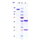 SDS-PAGE - Etigilimab Biosimilar - Anti-TIGIT Antibody - Low endotoxin, Azide free (A323437) - Antibodies.com