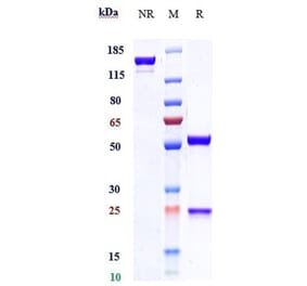 SDS-PAGE - Etokimab Biosimilar - Anti-IL-33 Antibody - Low endotoxin, Azide free (A323438) - Antibodies.com