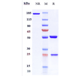 SDS-PAGE - Evinacumab Biosimilar - Anti-ANGPTL3 Antibody - Low endotoxin, Azide free (A323440) - Antibodies.com