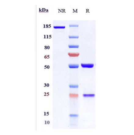 SDS-PAGE - Evinacumab Biosimilar - Anti-ANGPTL3 Antibody - Low endotoxin, Azide free (A323440) - Antibodies.com