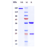 SDS-PAGE - Evinacumab Biosimilar - Anti-ANGPTL3 Antibody - Low endotoxin, Azide free (A323440) - Antibodies.com