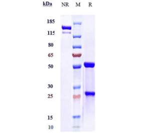 SDS-PAGE - Evolocumab Biosimilar - Anti-PCSK9 Antibody - Low endotoxin, Azide free (A323441) - Antibodies.com