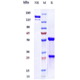 SDS-PAGE - Evolocumab Biosimilar - Anti-PCSK9 Antibody - Low endotoxin, Azide free (A323441) - Antibodies.com