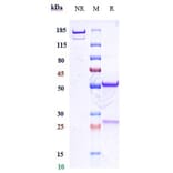 SDS-PAGE - Felzartamab Biosimilar - Anti-CD38 Antibody - Low endotoxin, Azide free (A323449) - Antibodies.com