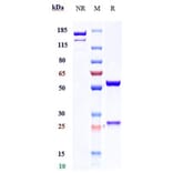 SDS-PAGE - Fezakinumab Biosimilar - Anti-IL-22 Antibody - Low endotoxin, Azide free (A323450) - Antibodies.com