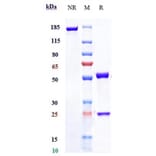 SDS-PAGE - Fletikumab Biosimilar - Anti-IL-20 Antibody - Low endotoxin, Azide free (A323456) - Antibodies.com