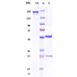 SDS-PAGE - Foralumab Biosimilar - Anti-CD3 epsilon Antibody - Low endotoxin, Azide free (A323459) - Antibodies.com