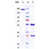 SDS-PAGE - Foravirumab Biosimilar - Anti-Rabies Virus Glycoprotein Antibody - Low endotoxin, Azide free (A323460) - Antibodies.com
