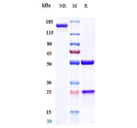 SDS-PAGE - Fremanezumab Biosimilar - Anti-CGRP-I Antibody - Low endotoxin, Azide free (A323461) - Antibodies.com