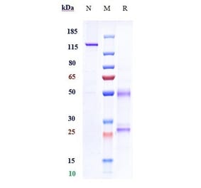 SDS-PAGE - Fulranumab Biosimilar - Anti-NGF Antibody - Low endotoxin, Azide free (A323464) - Antibodies.com