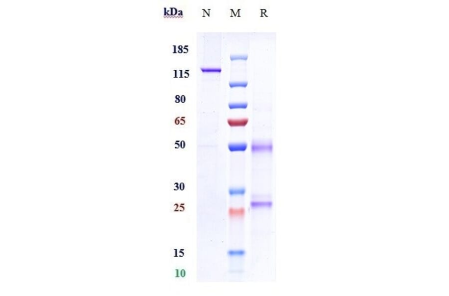 SDS-PAGE - Fulranumab Biosimilar - Anti-NGF Antibody - Low endotoxin, Azide free (A323464) - Antibodies.com