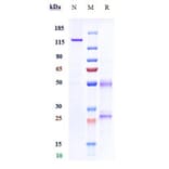 SDS-PAGE - Fulranumab Biosimilar - Anti-NGF Antibody - Low endotoxin, Azide free (A323464) - Antibodies.com